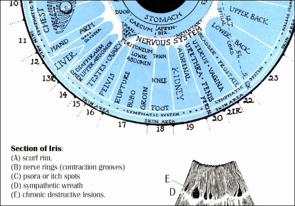 Iridiagnosis Iridology Chart