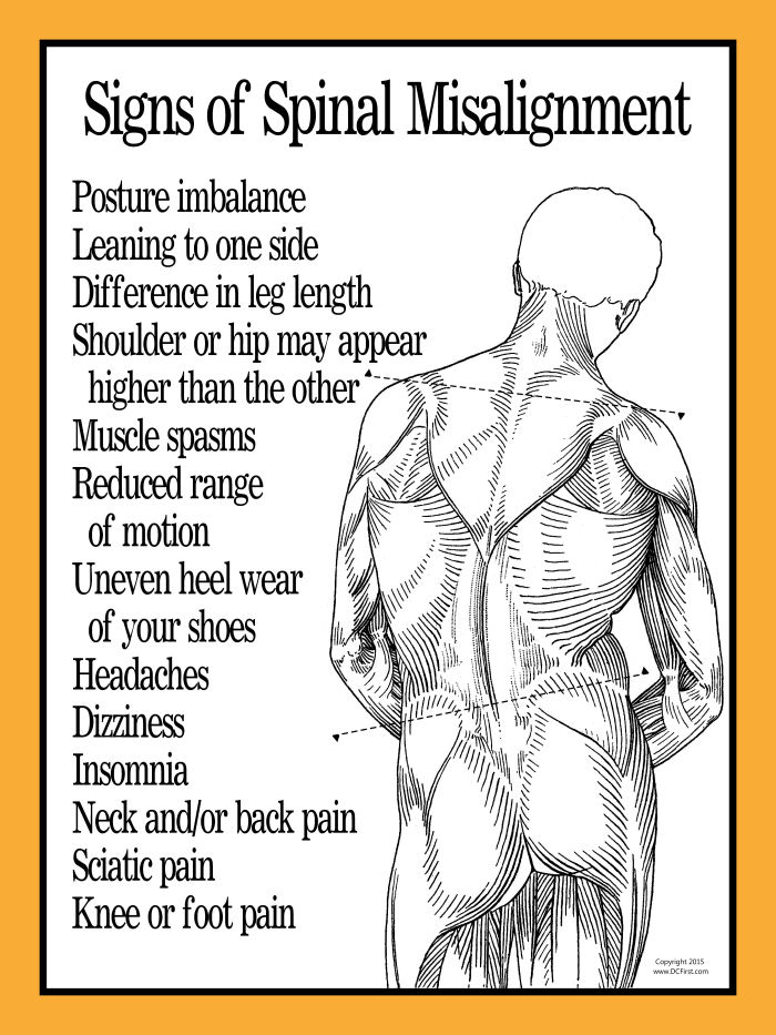 Signs of Spinal Misalignment