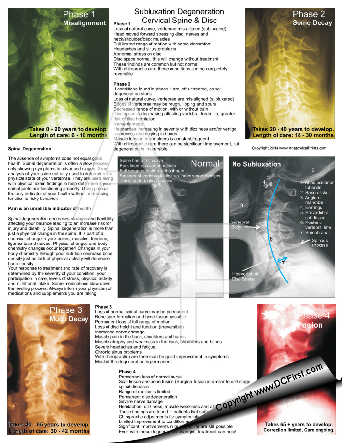 Cervical Subluxation Degeneration Pad