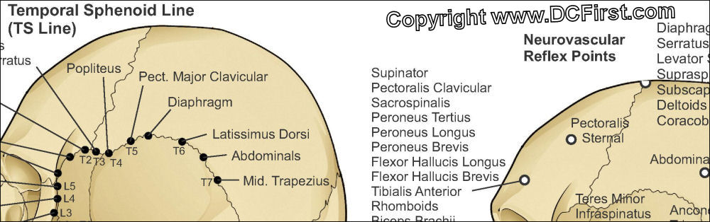 Temporal Sphenoidal Line