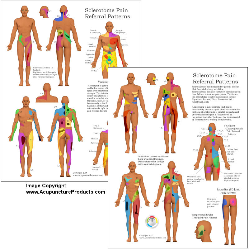 Sclerotome and Visceral Pain Referral Petterns