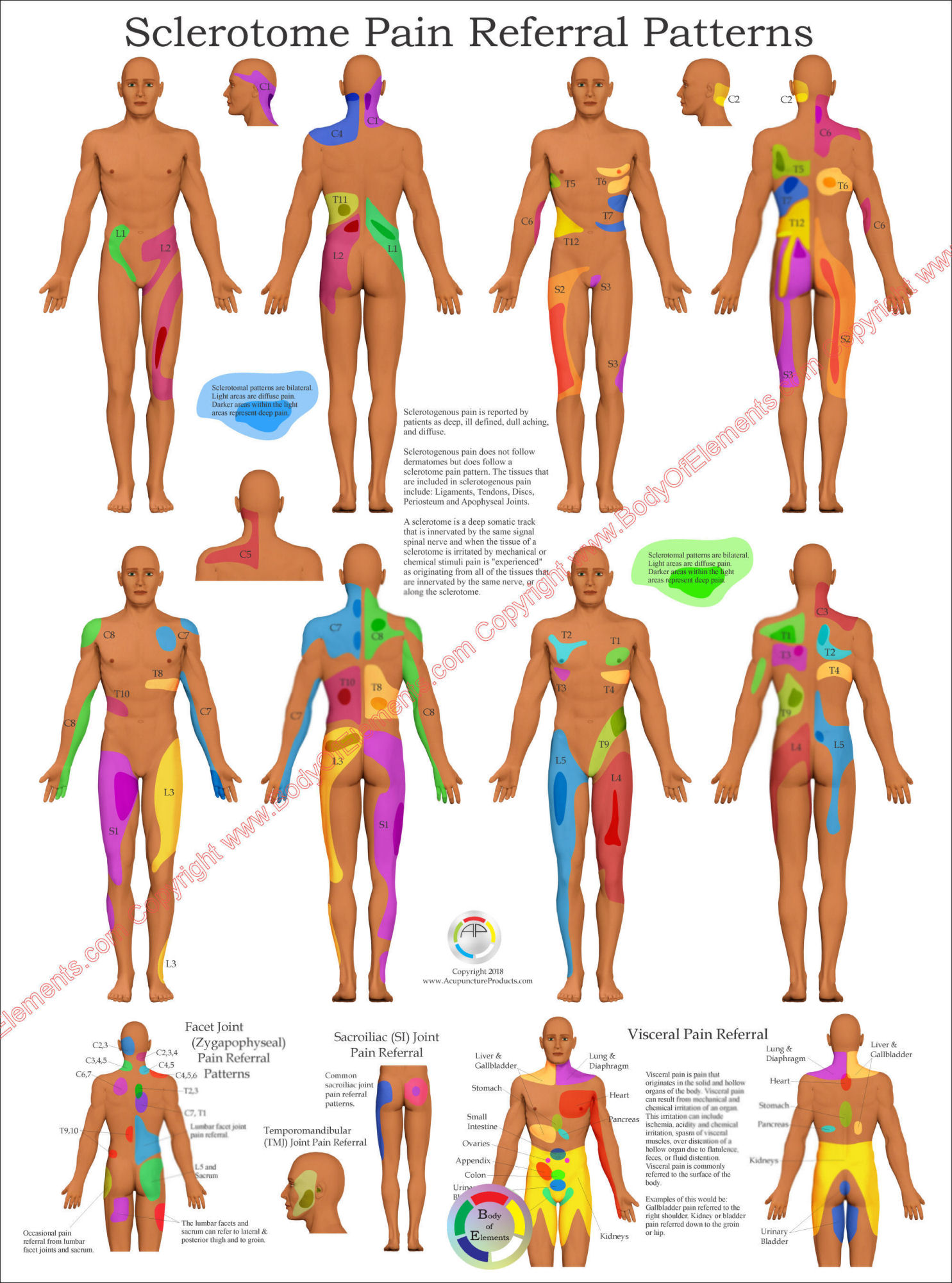 Sclerotome Pain Referral Poster