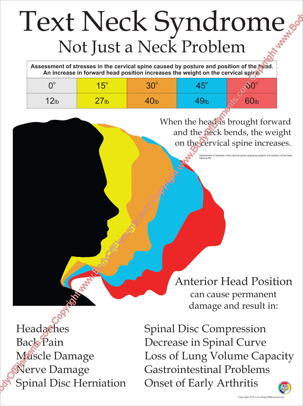 Text Neck Syndrome Poster